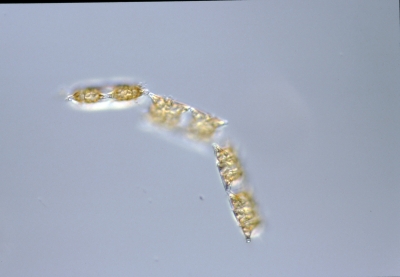 Biddulphia aurita
