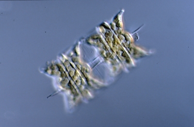 Biddulphia aurita