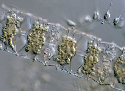 Biddulphia aurita