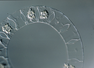 Biddulphia aurita