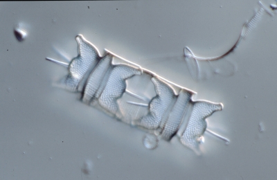 Biddulphia aurita