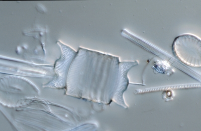 Biddulphia aurita