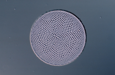 Coscinodiscus radiatus