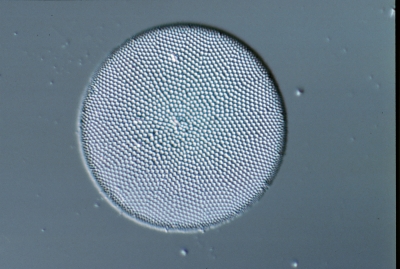 Coscinodiscus spec.
