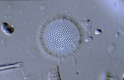 Coscinodiscus excentricus