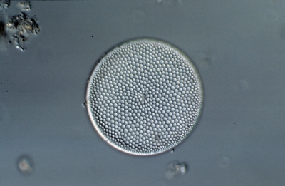 Coscinodiscus argus