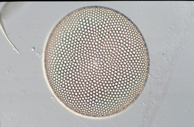 Coscinodiscus argus