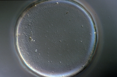 Coscinodiscus concinnus