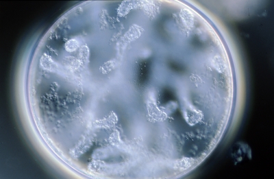 Coscinodiscus concinnus