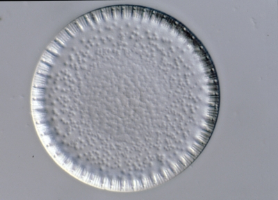 Coscinodiscus cinctus