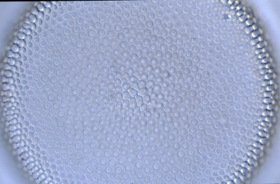 Coscinodiscus centralis