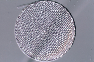 Coscinodiscus arg us