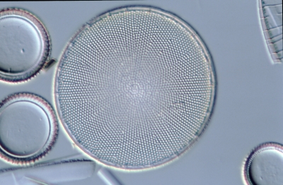 Coscinodiscus rothii