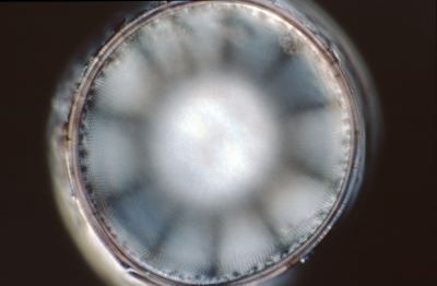 Coscinodiscus spec.