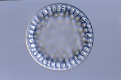 Coscinodiscus moelleri