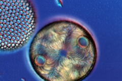 Coscinodiscus / Auliscus