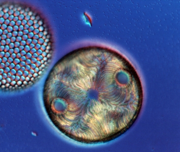 Coscinodiscus/Auliscus