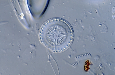 Cyclotella radiosa