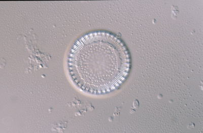 Cyclotella radiosa