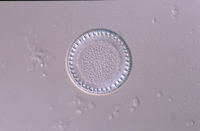 Cyclotella radiosa