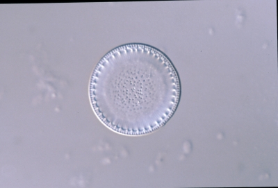 Cyclotella radiosa