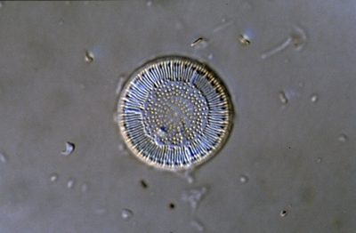 Cyclotella radiosa