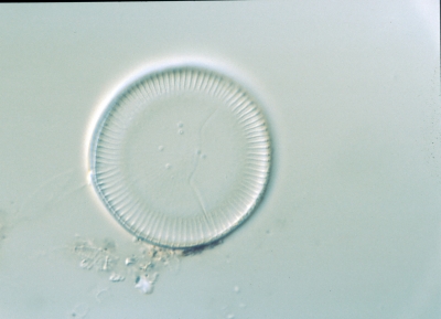 Cyclotella meneghiniana