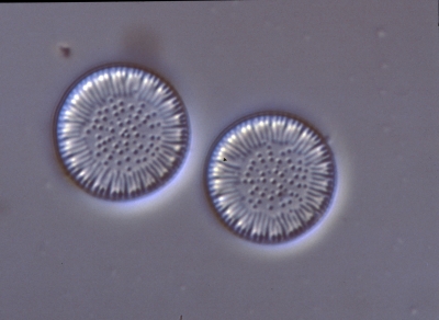 Cyclotella radiosa