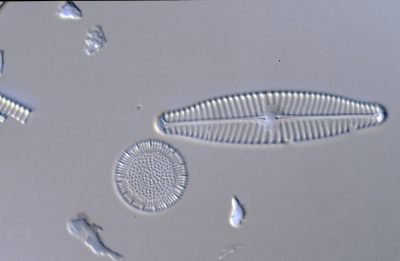 Cyclotella radiosa