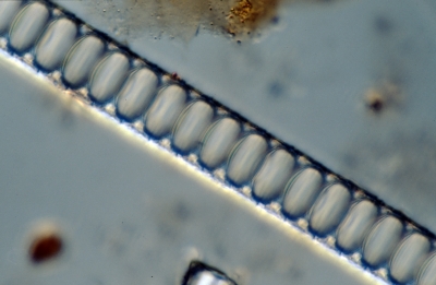 Cyclotella meneghiniana?