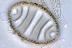 Cymatopleura