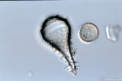 Dauerspore