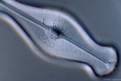 Didymosphaenia
