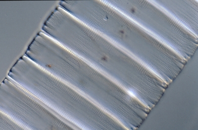 Eunotia spec.