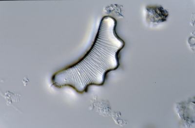 Eunotia serra f. tetraedron