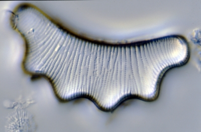 Eunotia serra f. tetraedron