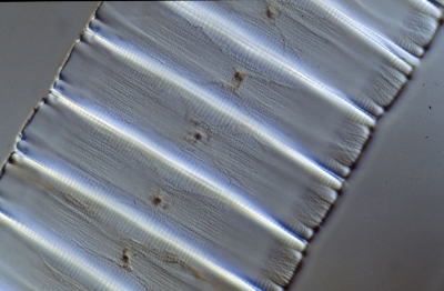 Eunotia spec.