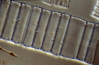 Eunotia spec.