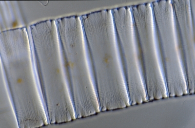 Eunotia spec.