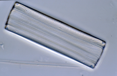 Eunotia spec.