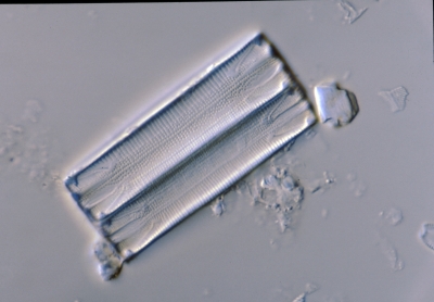 Eunotia spec.
