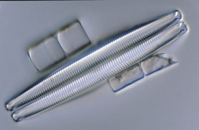 Eunotia spec.