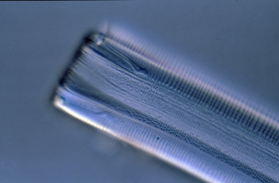 Eunotia flexuosa?