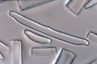 Eunotia pectinalis
