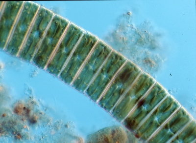 Eunotia spec.