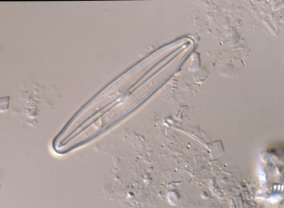 Frustulia vulgaris