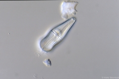 Gomphonema