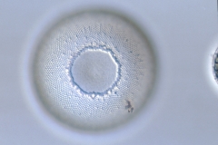 Hyalodiscus