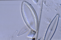 Nitzschia