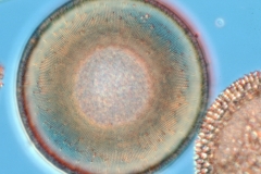 Poro / Hyalodiscus?